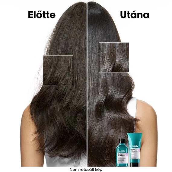 Loreal Scalp Advanced nyugtató sampon érzékeny fejbőrre, 500 ml